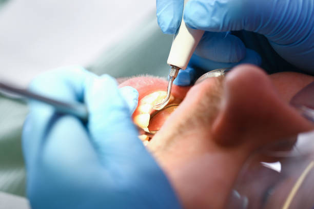 Best Pediatric Emergency Dentist in Woodinville, WA