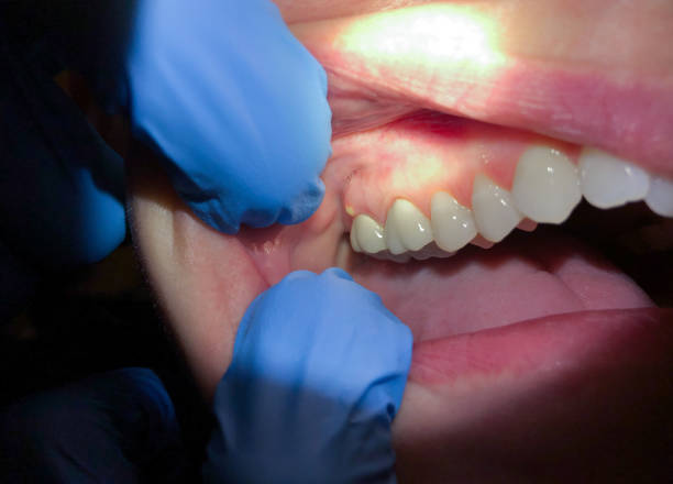 Best Mobile Emergency Dentist in Woodinville, WA